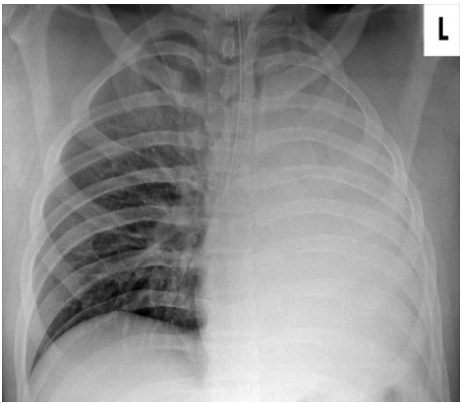 Solved: “Win 2000 points – Comment on this new X-Ray”